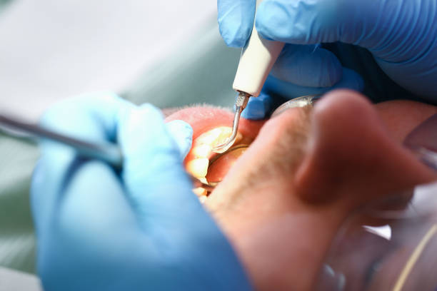 Best Emergency Cosmetic Dentistry (e.g., broken veneers) in Cudahy, CA