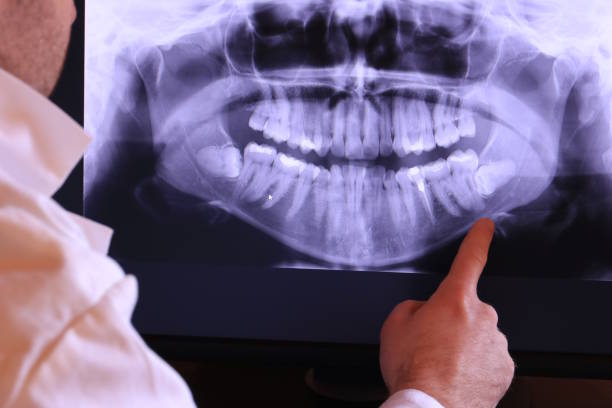 Best Emergency Treatment for Jaw Pain or Injury in Cudahy, CA