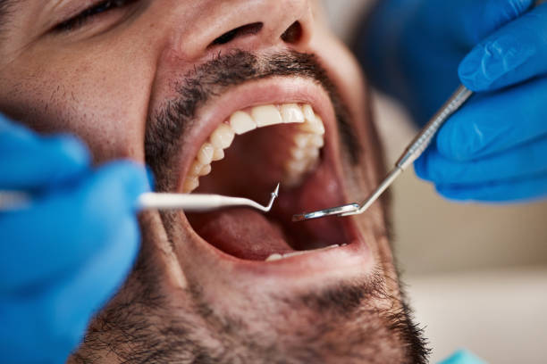 Best Emergency Cosmetic Dentistry (e.g., broken veneers) in Cudahy, CA